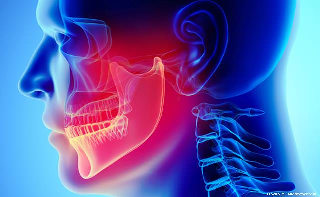 Kiefergelenksprobleme werden oft für Ohrenschmerzen gehalten.