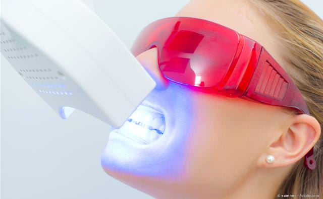 Power-Bleaching: Weiße Zähne in einem Termin